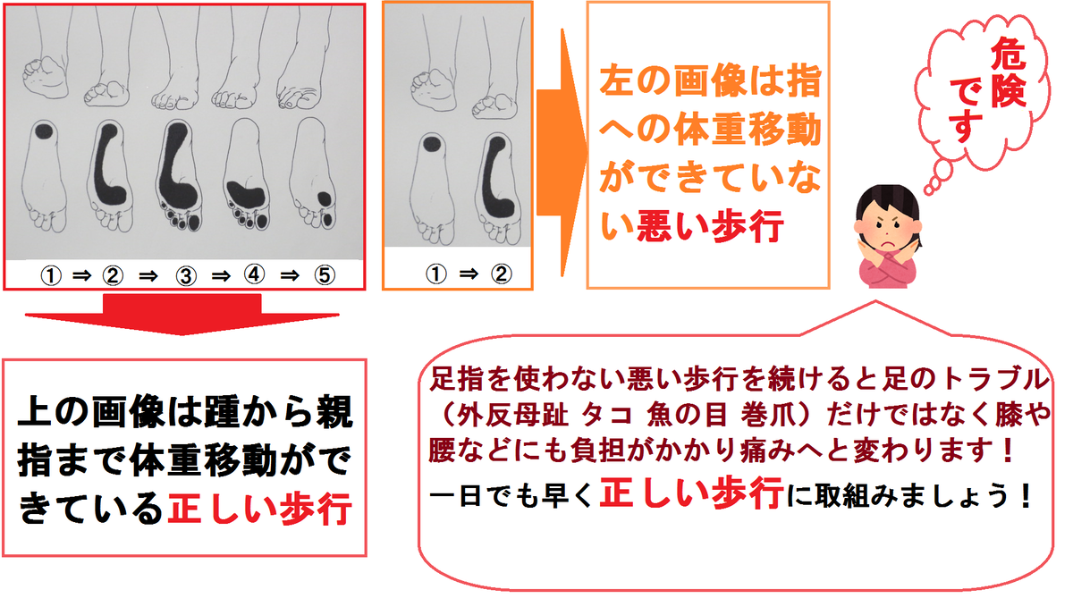 足の痛みを根本治療 蓮田市外反母趾研究所